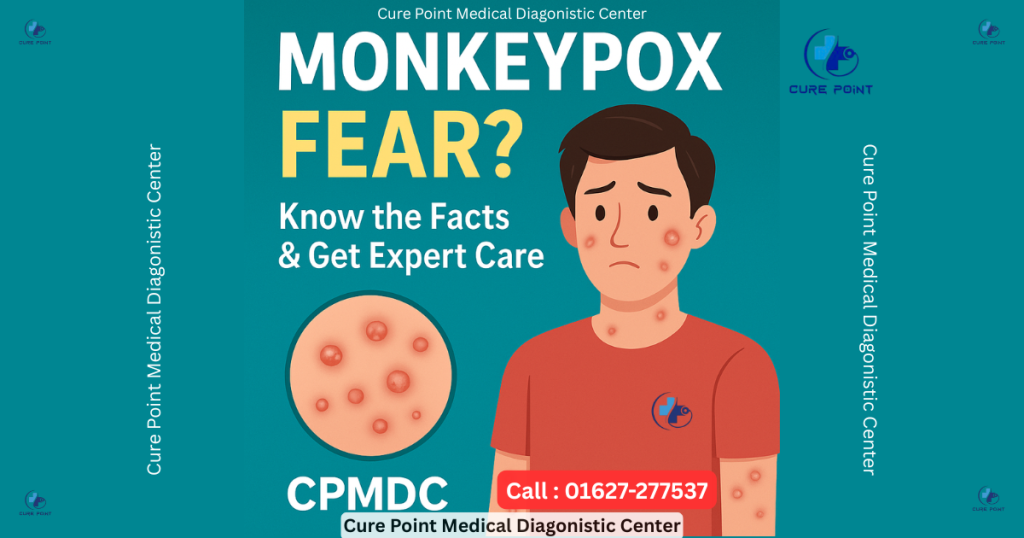 Monkeypox