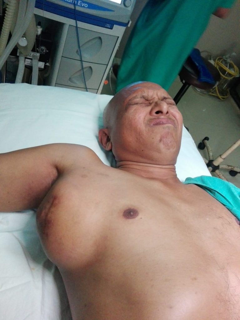 Before Operation - Dr. Mohammad Abdullah Al Mamun