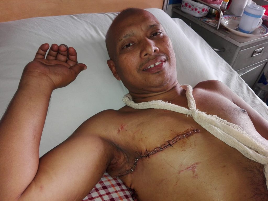 After Operation - Dr. Mohammad Abdullah Al Mamun