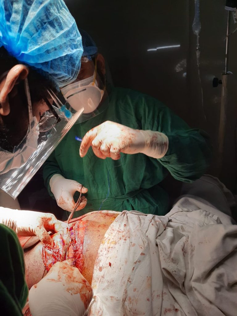 Laparoscopic Cholecystectomy - Due to gall bladder stone - Dr. Mohammad Abdullah Al Mamun