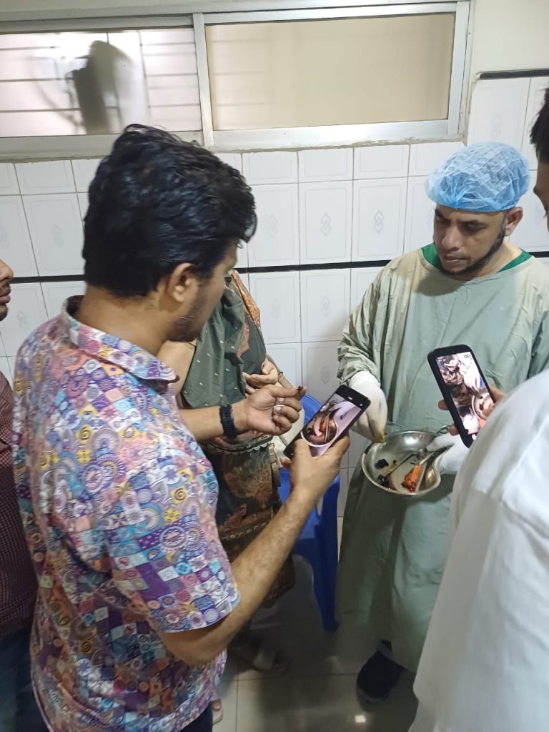 Laparoscopic Cholecystectomy - Due to gall bladder stone - Dr. Mohammad Abdullah Al Mamun