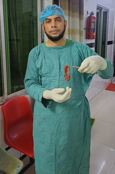 Gallbladder Operation - Dr. Mohammad Abdullah Al Mamun