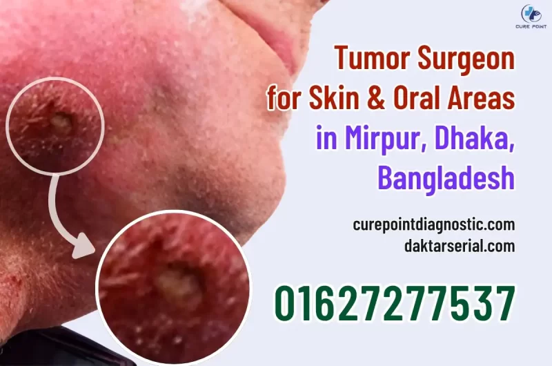 Expert Tumor Surgeon for Skin & Oral Areas in Mirpur