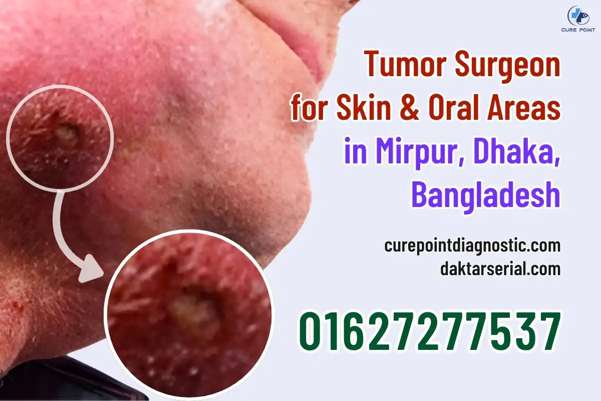 Expert Tumor Surgeon for Skin & Oral Areas in Mirpur