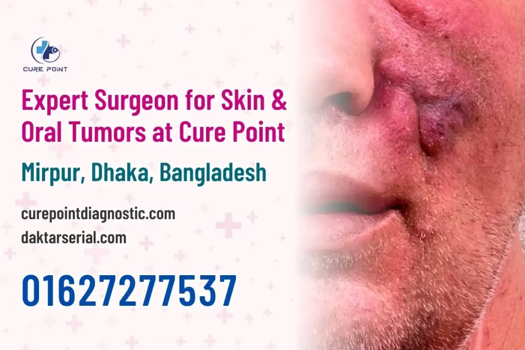 Expert Surgeon for Skin & Oral Tumors at Cure Point - Dr. Mohammad Abdullah Al Mamun