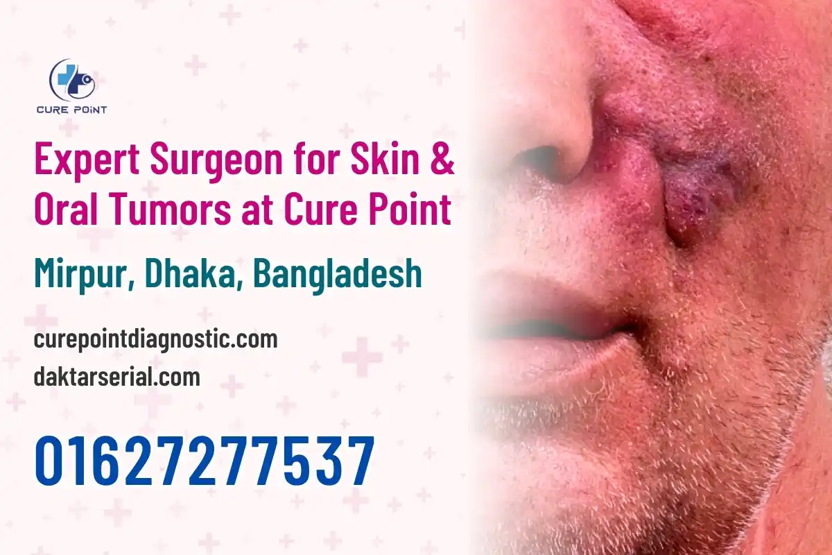 Expert Surgeon for Skin & Oral Tumors at Cure Point